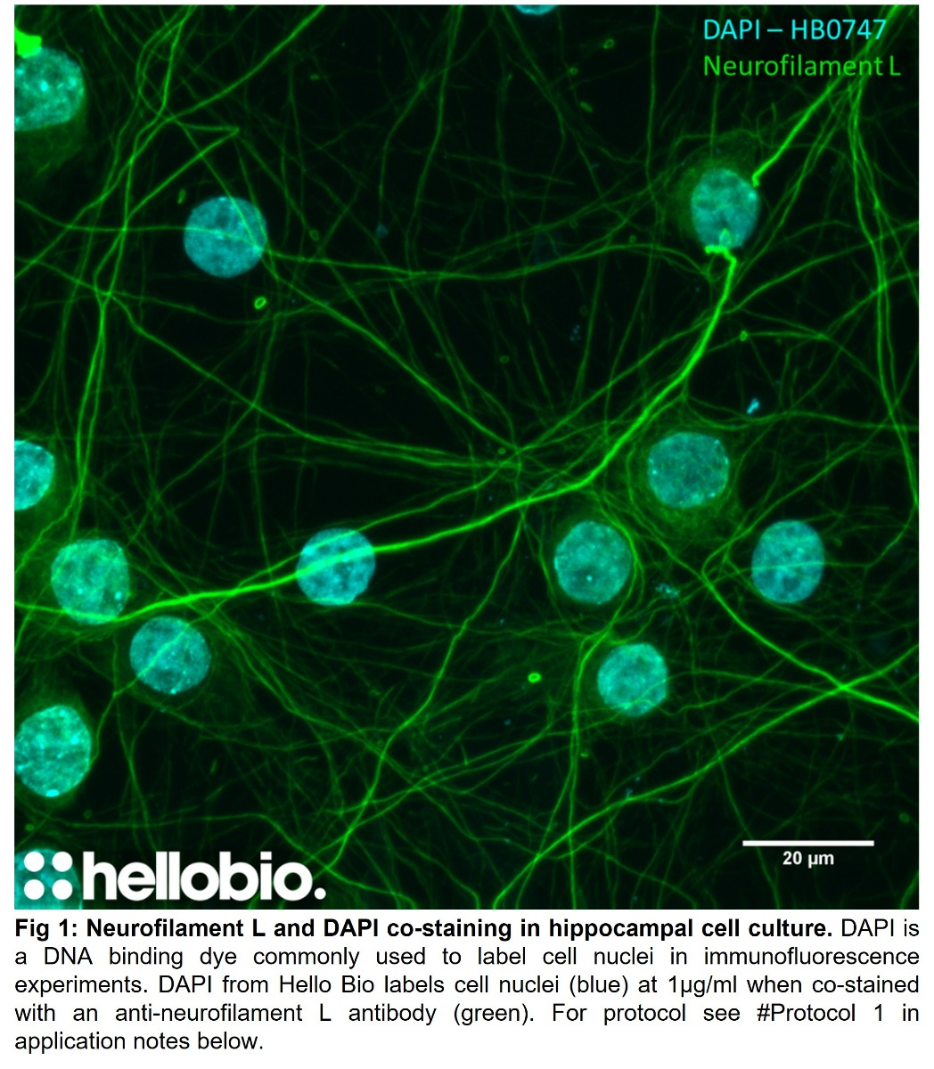 Fig 1: Neurofilament L and DAPI co-staining in hippocampal cell culture. 