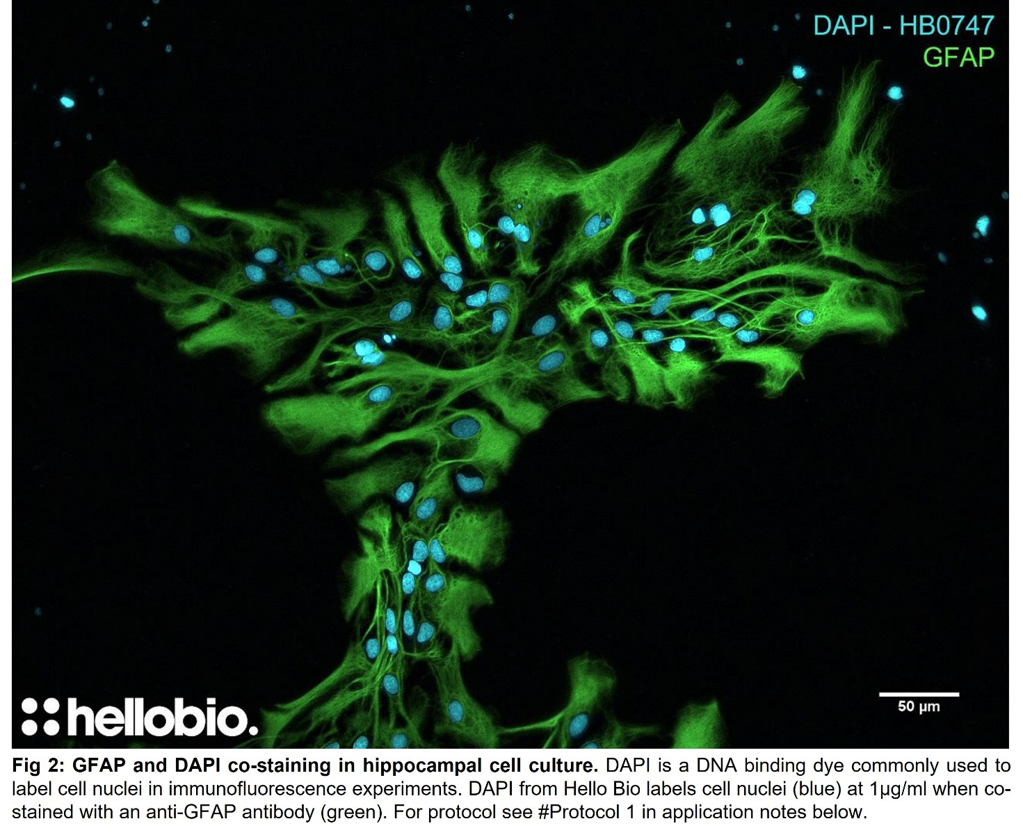 Fig 2: GFAP and DAPI co-staining in hippocampal cell culture. 