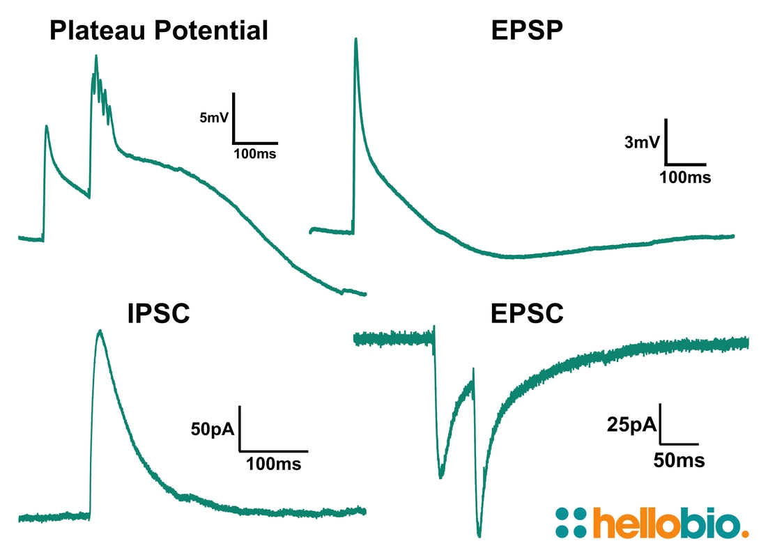 Figure 1. Representative traces of different experiment types carried out in HB9200 aCSF