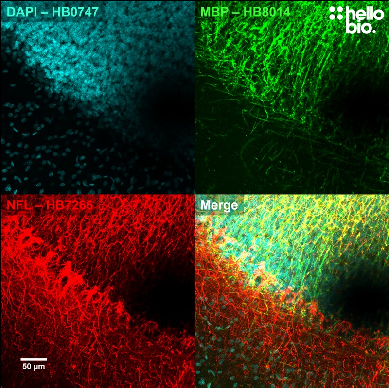 Figure 1. Myelin basic protein (MBP) and neurofilament L (NFL) staining in rat cerebellum visualised using HB8014.