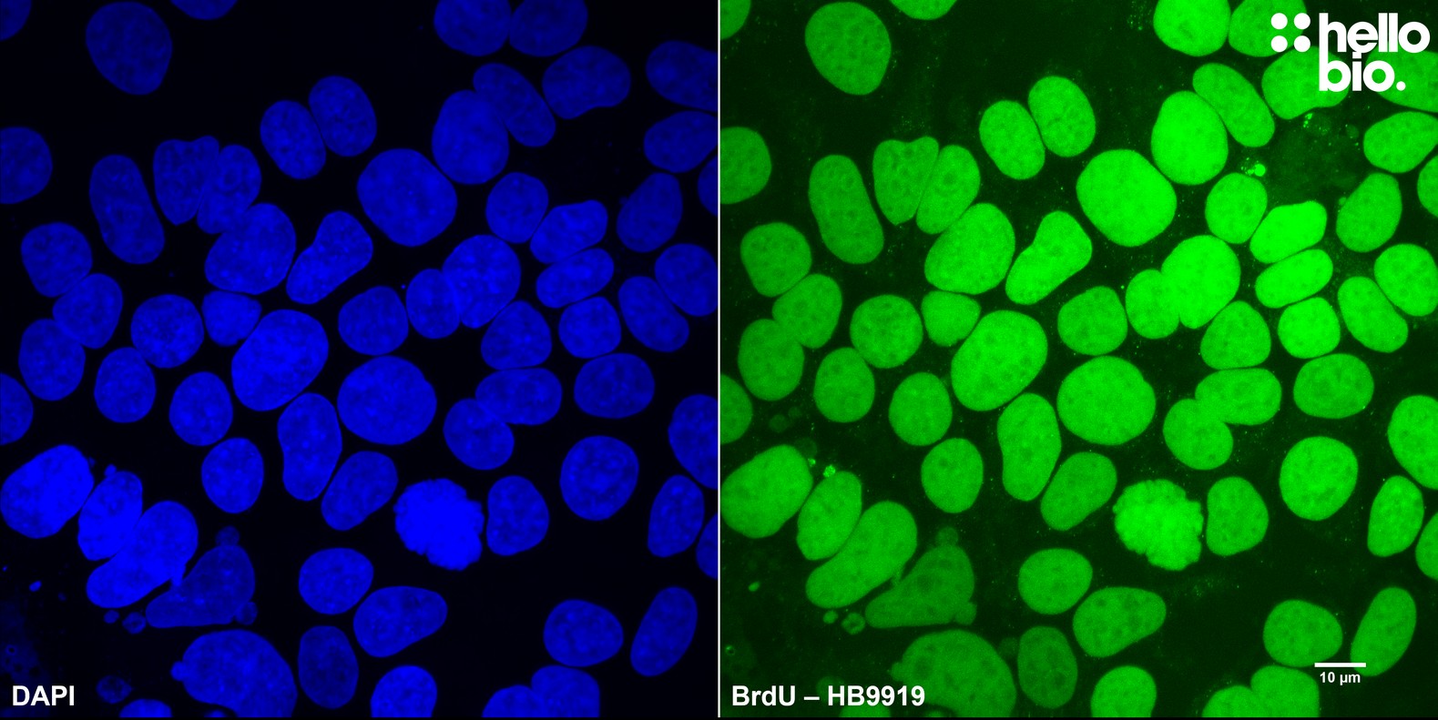 Figure 2. BrdU staining reveals proliferation in HEK293T cells using HB9919
