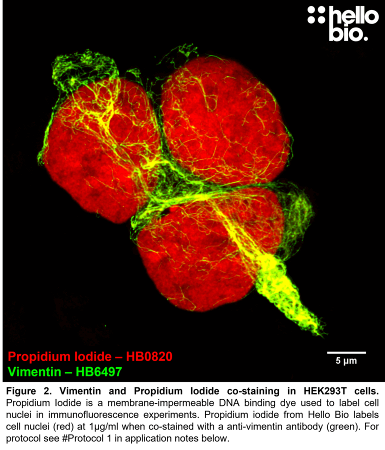 Figure 2. Vimentin and Propidium Iodide co-staining in HEK293T cells. 