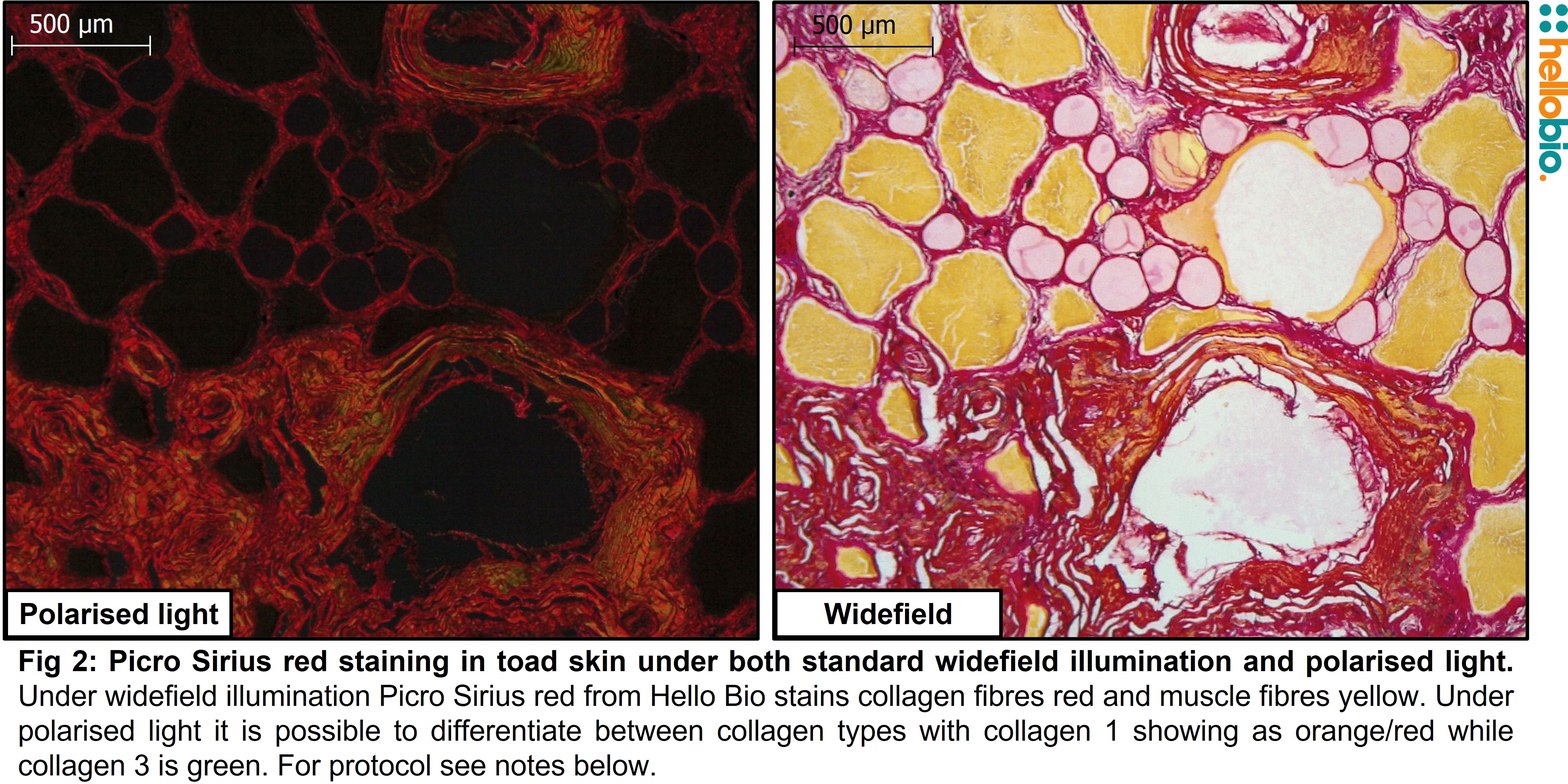 konkurrenter skæbnesvangre hvordan Picro Sirius Red Solution | Collagen/ Connective tissue Stain | Hello Bio