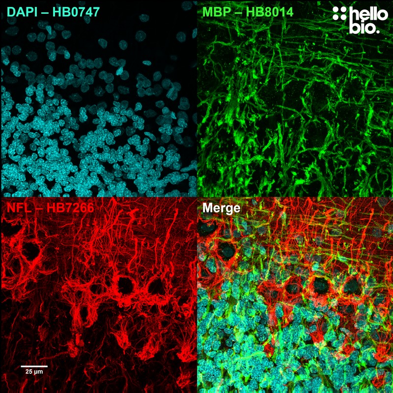 Figure 2. Myelin basic protein (MBP) and neurofilament L (NFL) staining in rat cerebellum visualised using HB8014.