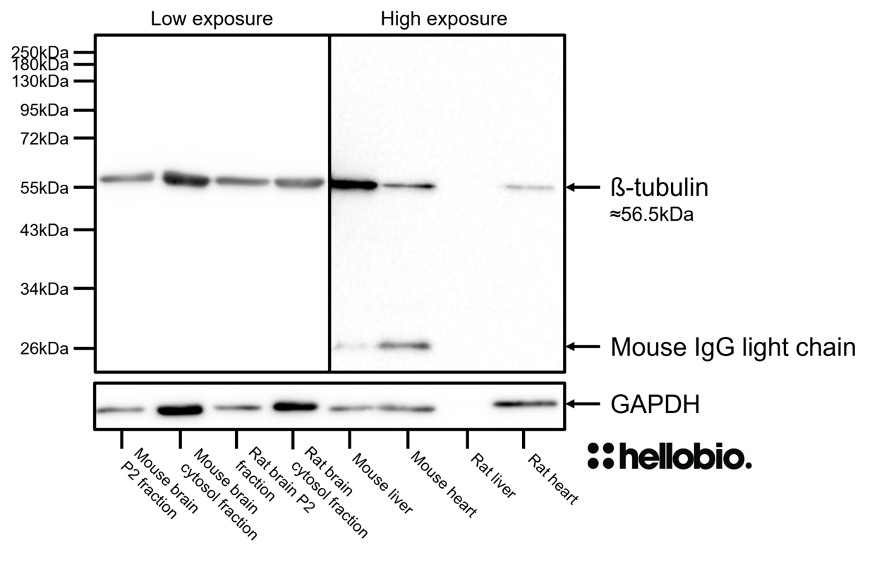 Figure 3. ß-Tubulin expression in various tissue lysates and preparations