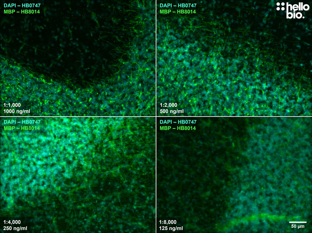 Figure 5. The effect of varying HB8014 concentration upon MBP staining in rat cerebellum. 