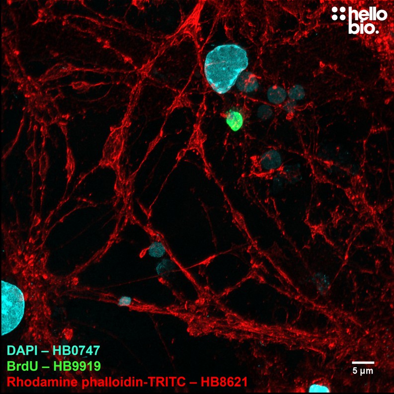 Figure 5. Proliferating cell in mixed neuronal cultures visualised with HB9919 staining.