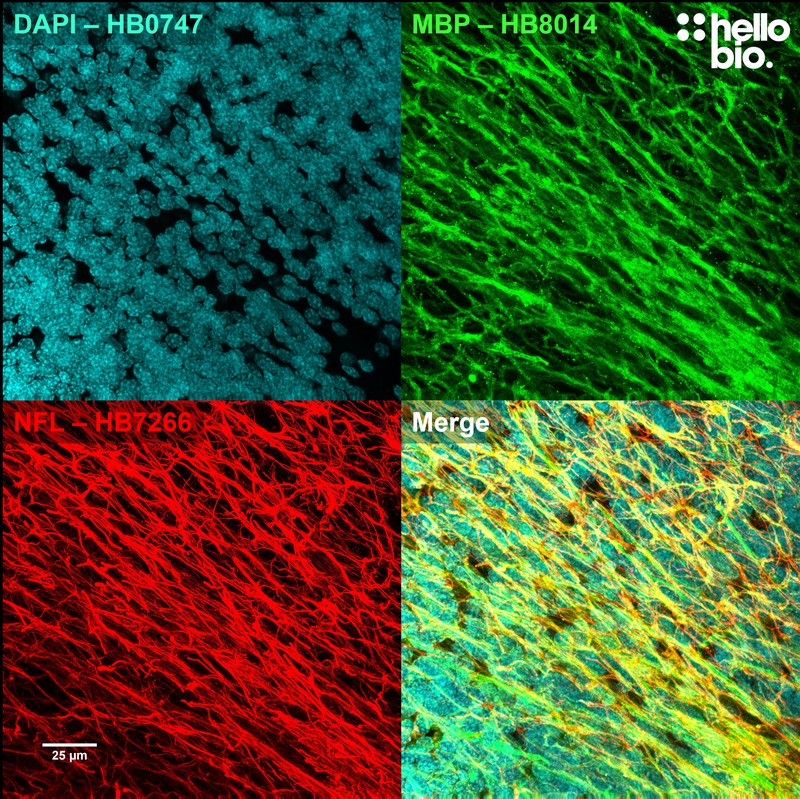 Figure 6. Myelin basic protein (MBP) and neurofilament L (NFL) staining of a dense axonal network in rat cerebellum visualised using HB8014.