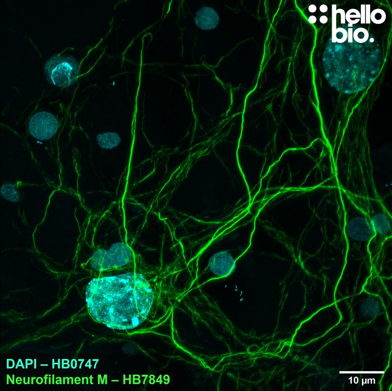 Figure 1. Neurofilament M expression in cultured rat neurones visualised using HB7849. 