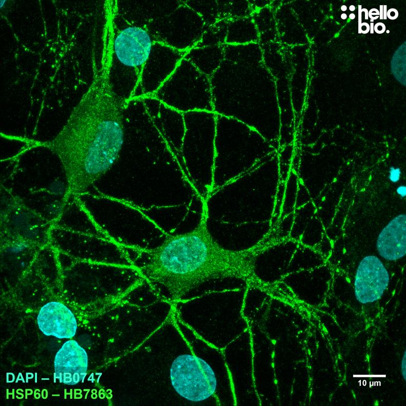 Figure 1. HSP60 staining with HB7863 reveals the dense mitochondria in cultured rat neurones. 