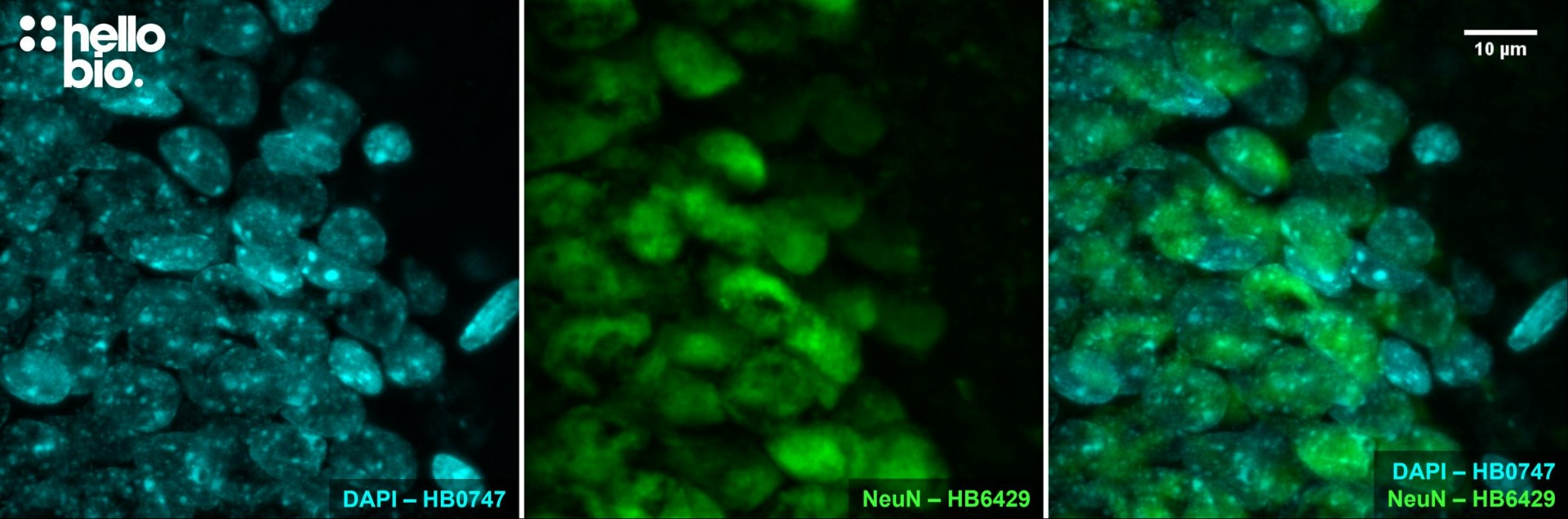 Figure 10. NeuN expression in the granule cell layer of the rat dentate gyrus visualised using HB6429. 