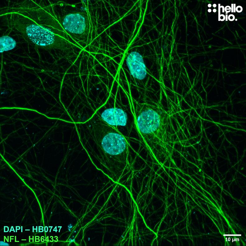 Figure 1. Neurofilament L expression in cultured rat neurones visualised using HB6433. 