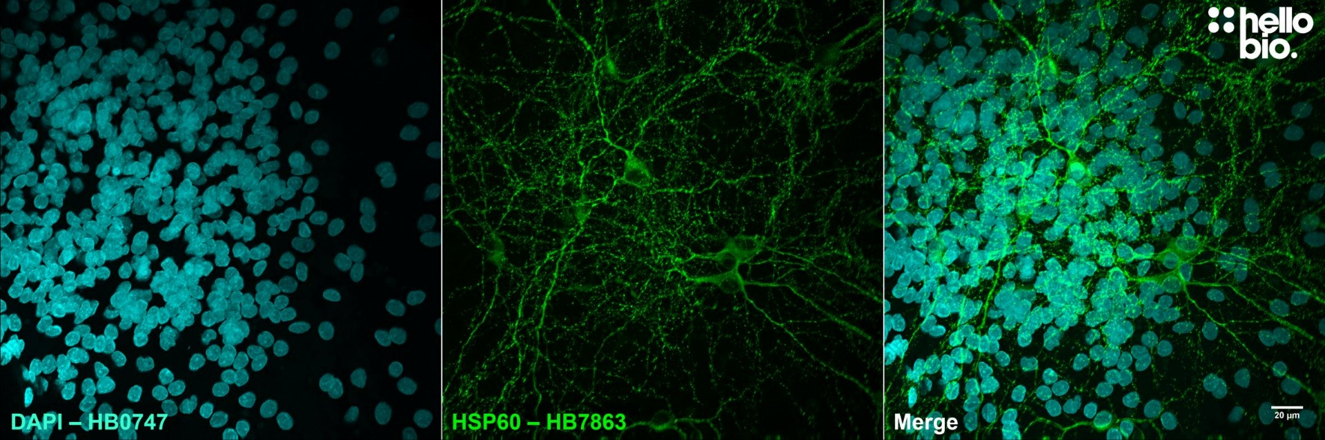 Figure 2. MAP2 expression in cultured rat neurones visualised using HB9587. 