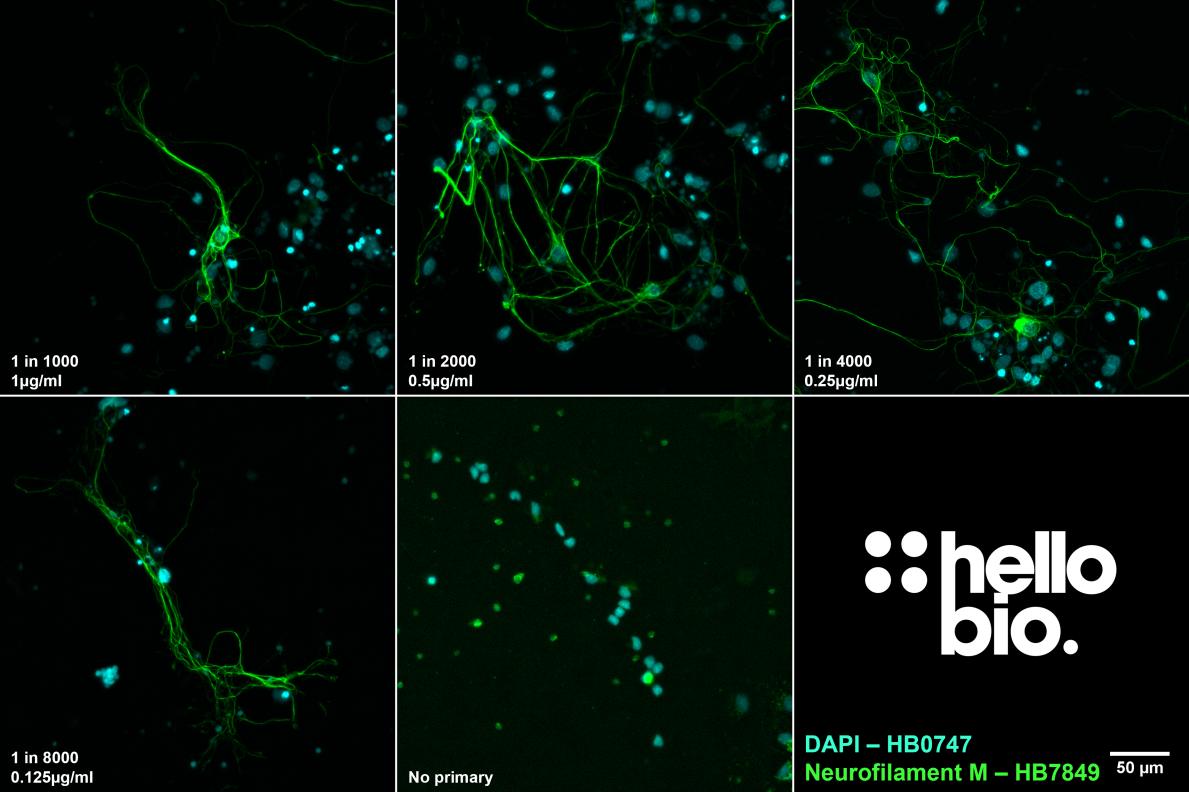Figure 2. The effect of varying HB7849 concentration upon staining in cultured rat neurones.