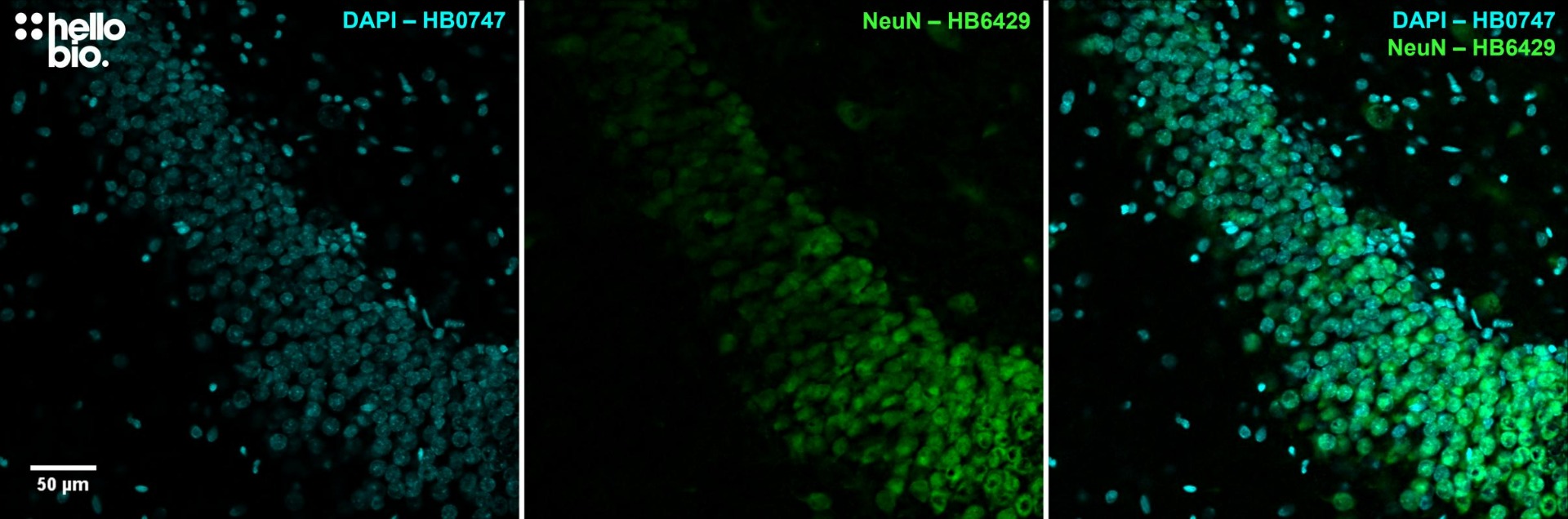 Figure 5. NeuN expression in the granule cell layer of the rat dentate gyrus visualised using HB6429. 