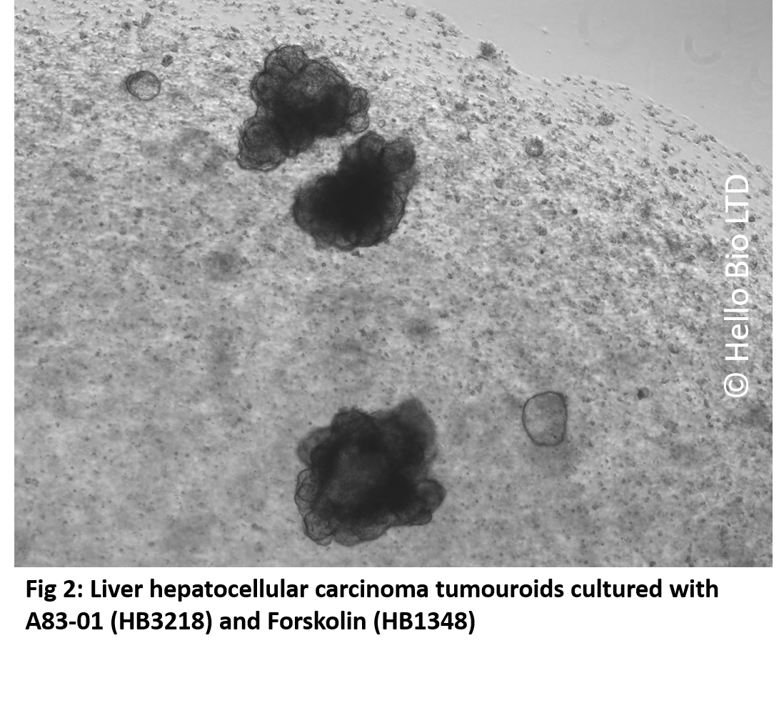 Fig 2 Liver hepatocellular carcinoma tumouroids cultured with A83-01 (HB3218) and Forskolin (HB1348)