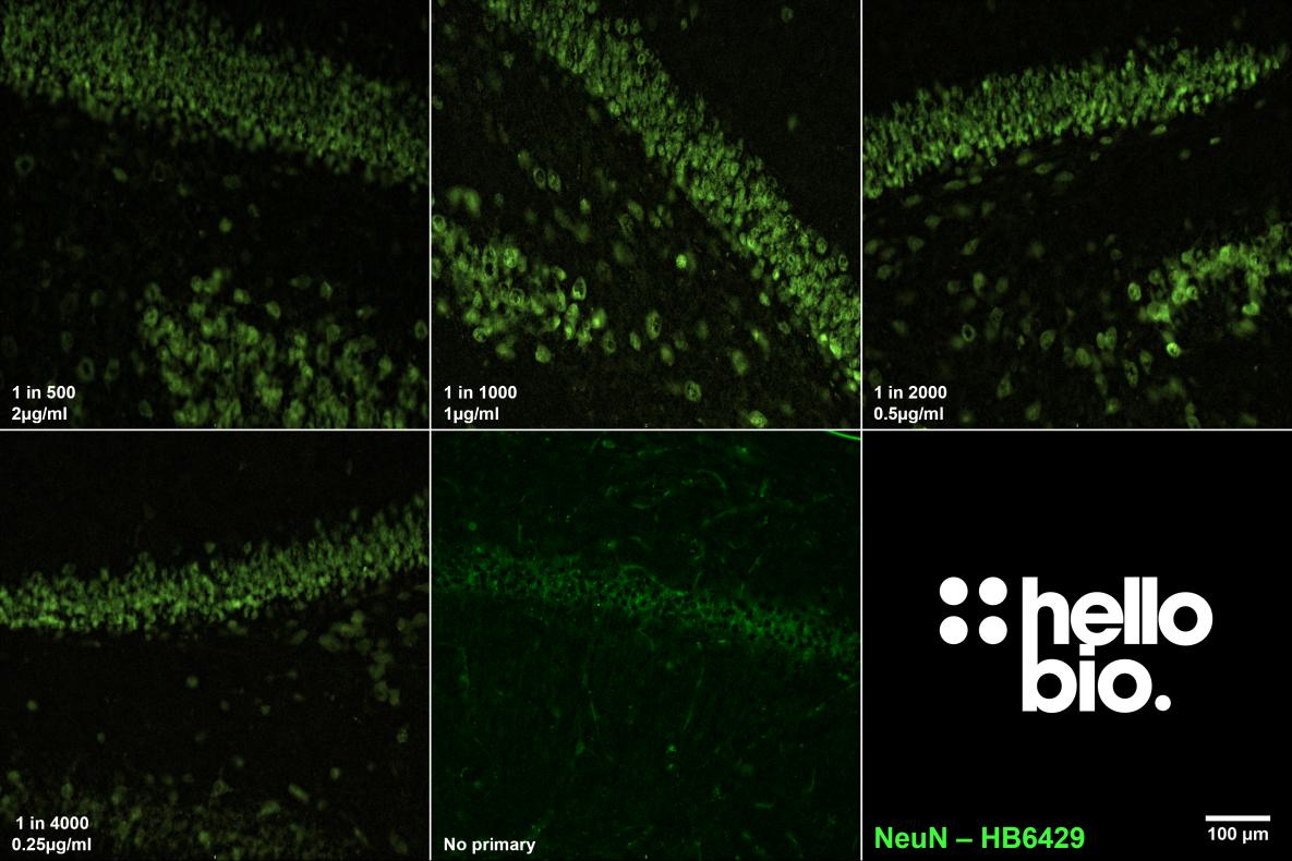 Figure 6. The effect of varying HB6429 concentration upon staining in rat dentate gyrus