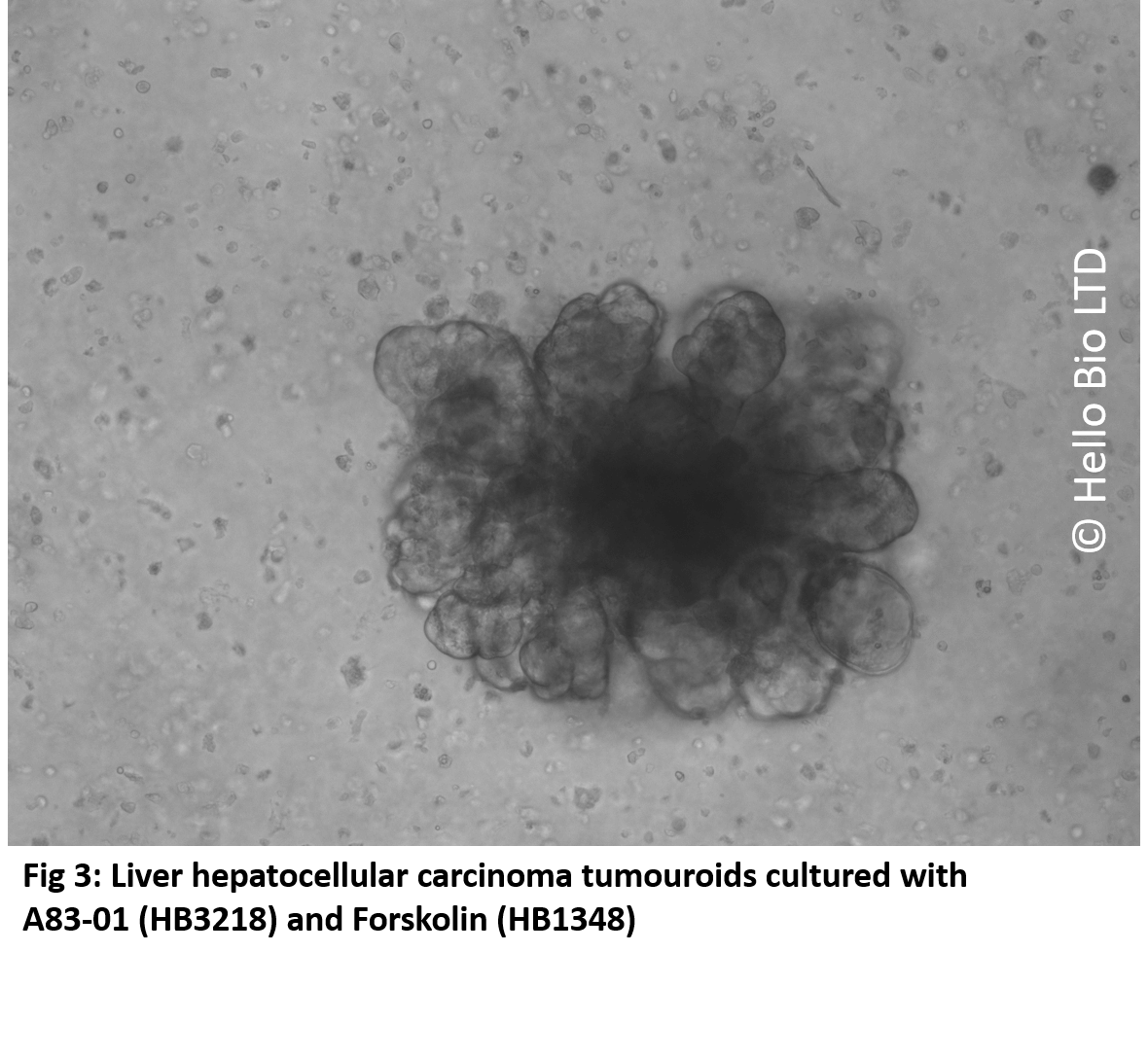 Fig 3 Liver hepatocellular carcinoma tumouroids cultured with A83-01 (HB3218) and Forskolin (HB1348)