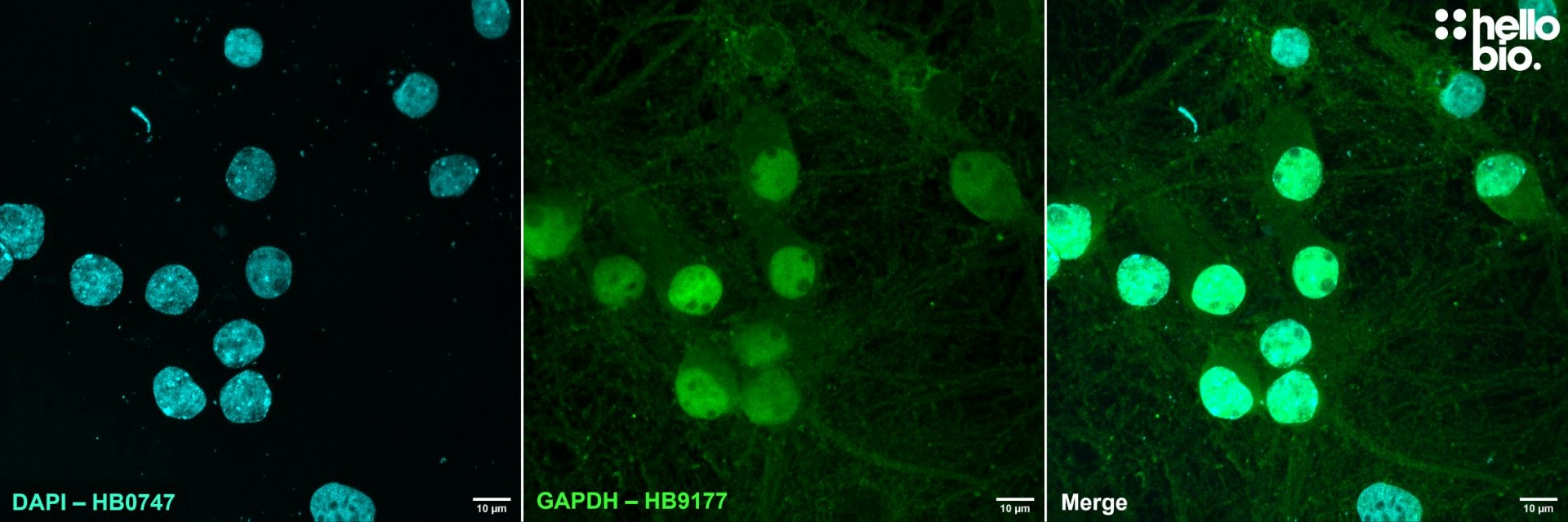 Figure 4. GAPDH expression in cultured rat neurones visualised using HB9177. 