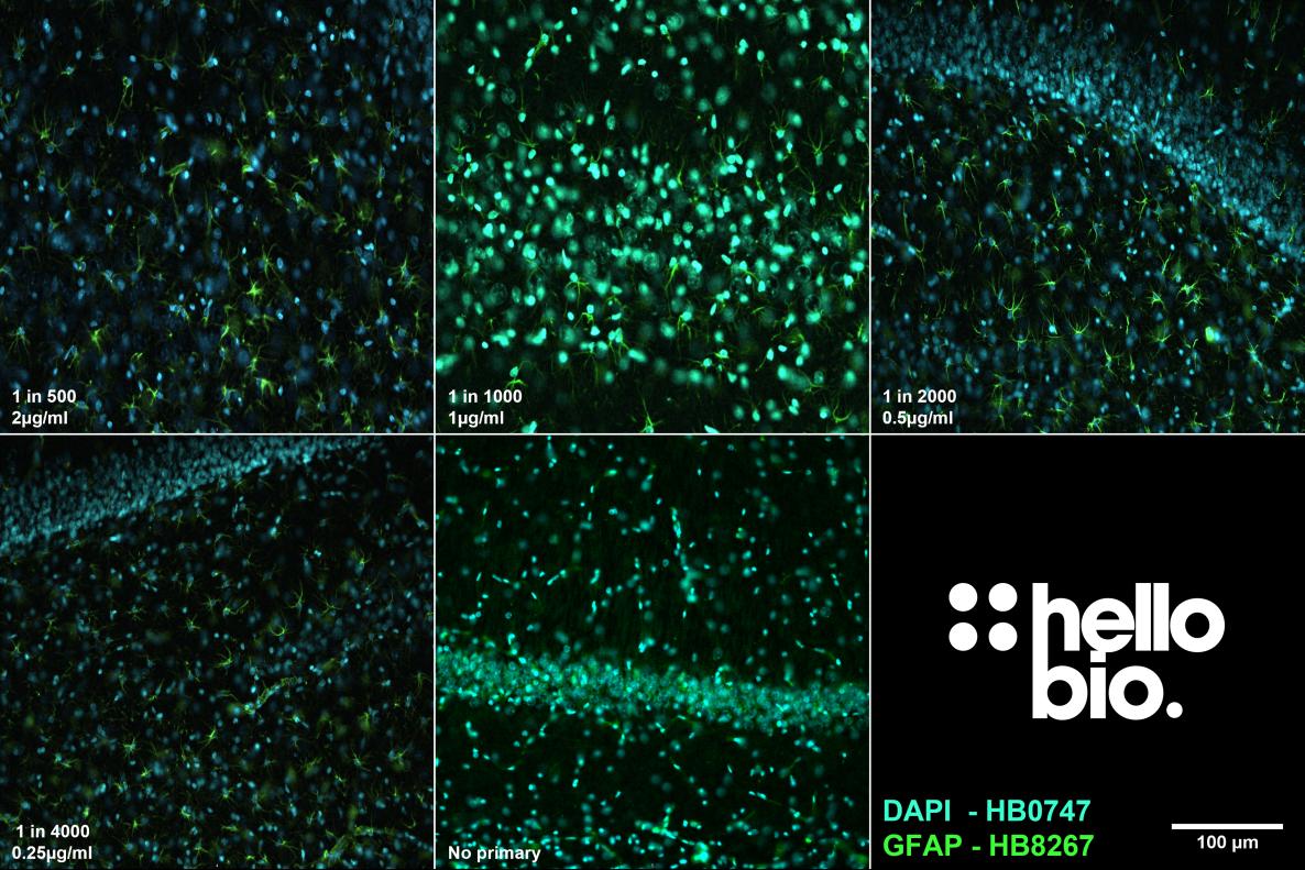 Figure 5. The effect of varying HB8267 concentration upon staining in rat hippocampus. 