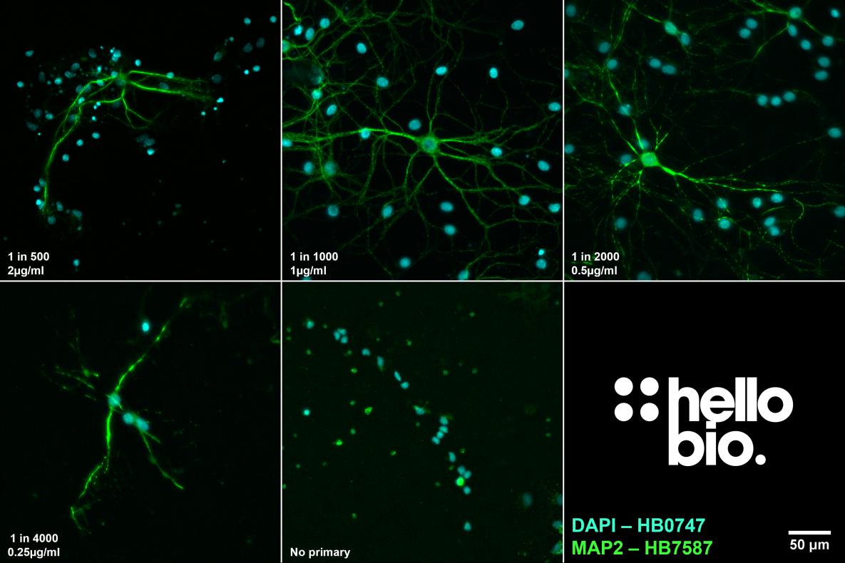 Figure 5. The effect of varying HB9587 concentration upon staining in cultured rat neurones. 