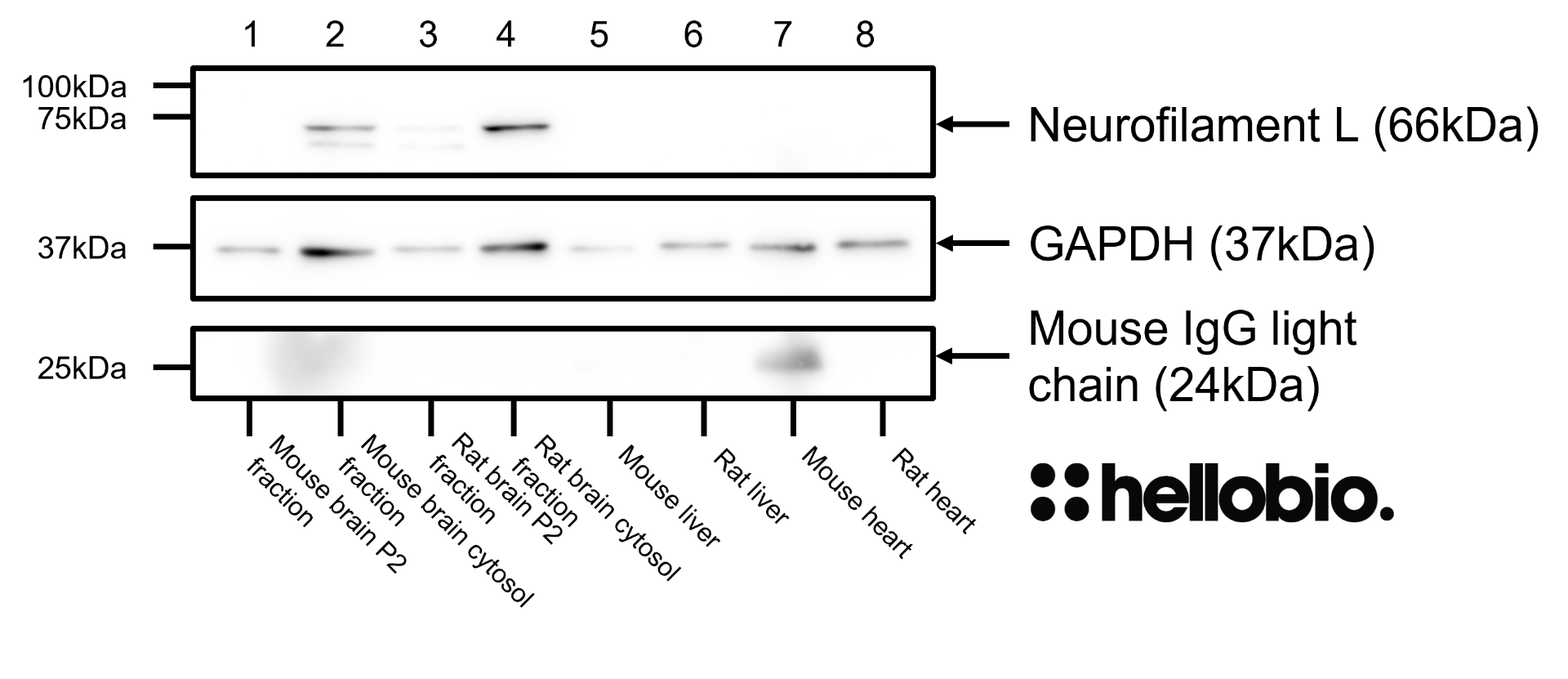Figure 6. Neurofilament L and GAPDH expression in various tissue lysates and preparations. 