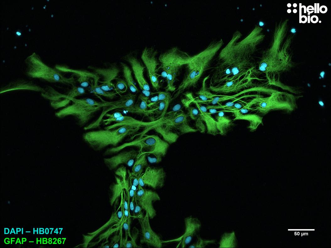 Figure 7. GFAP expression in a rat cultured neurone preparation visualised using HB8267. 