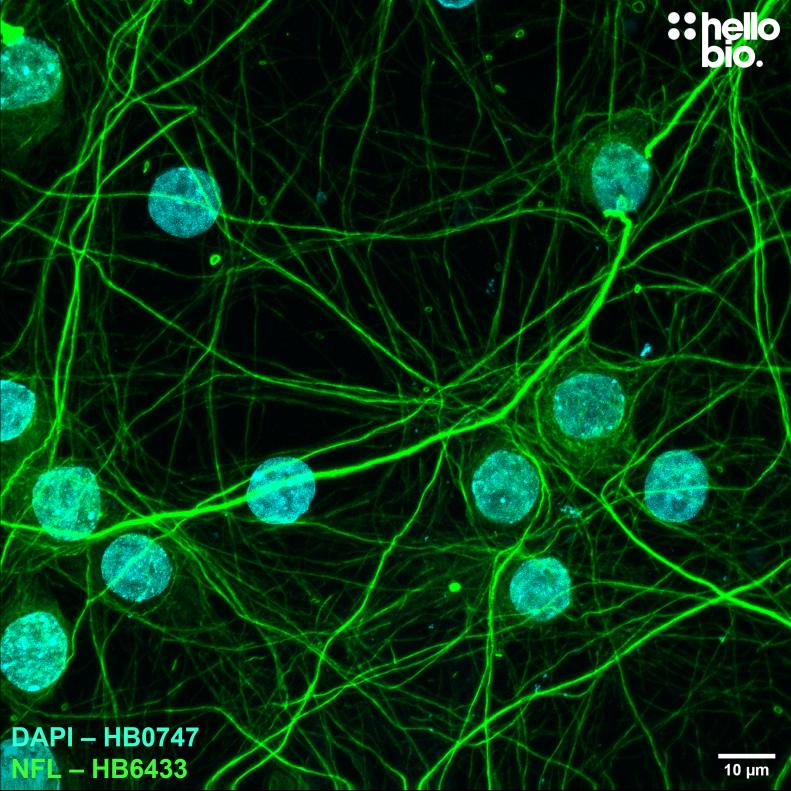 Figure 7. Neurofilament L expression in cultured rat neurones visualised using HB6433. 