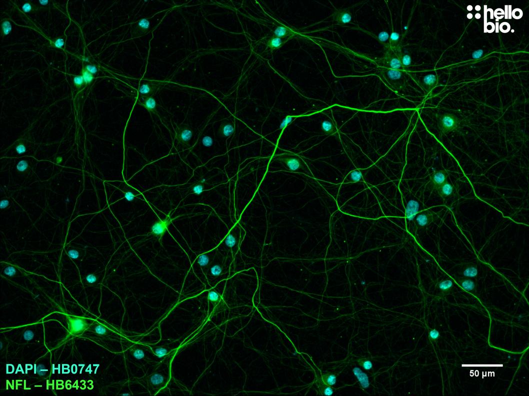 Figure 8. Neurofilament L expression in cultured rat neurones visualised using HB6433. 
