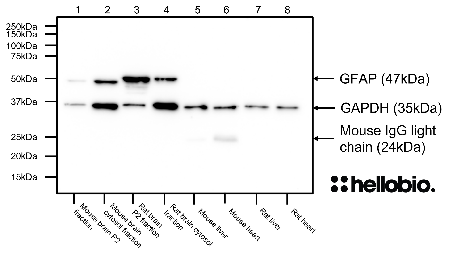 Figure 8. GFAP expression in various tissue lysates and preparations with GAPDH loading control. 