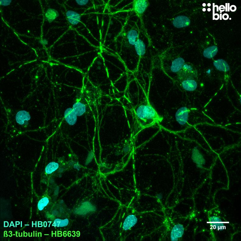 Figure 7. β3-tubulin expression visualised with HB6639 used to label cultured rat neurones. 