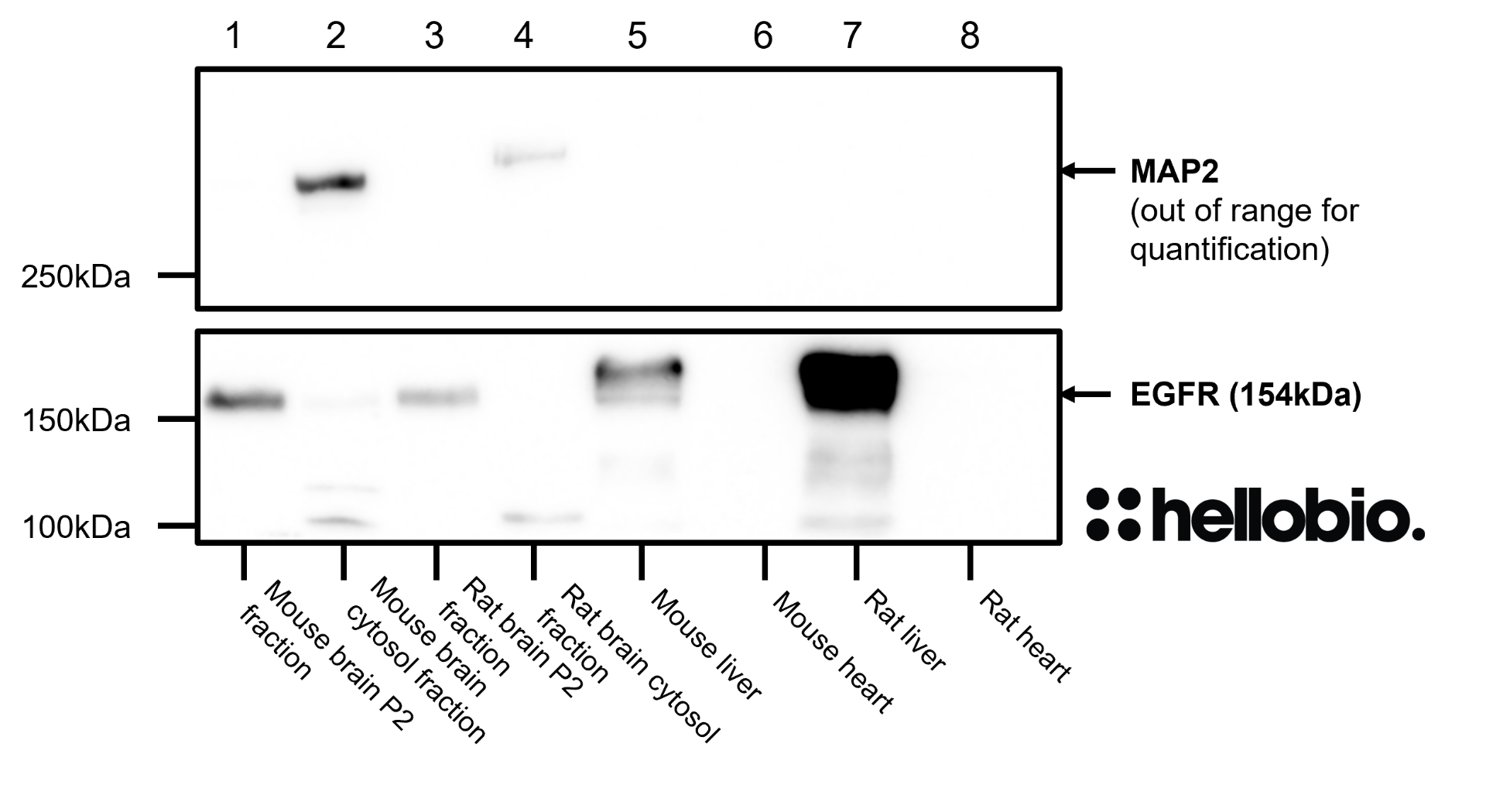 Figure 9. MAP2 and EGFR expression in various tissue lysates and preparations. 