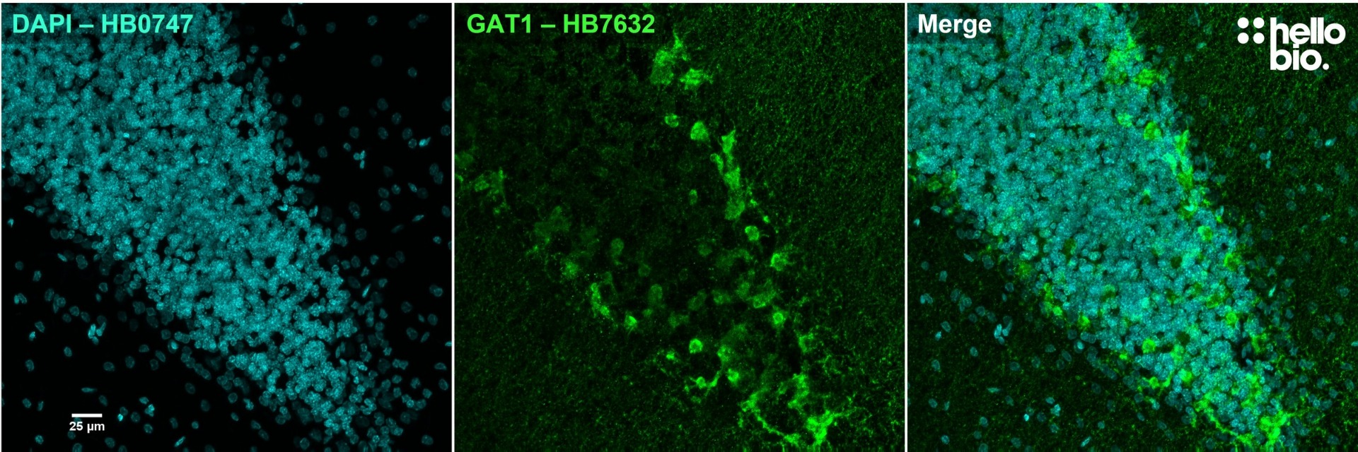 Figure 1. GAT1 staining in GABAergic interneurons of the cerebellum using HB7632. 
