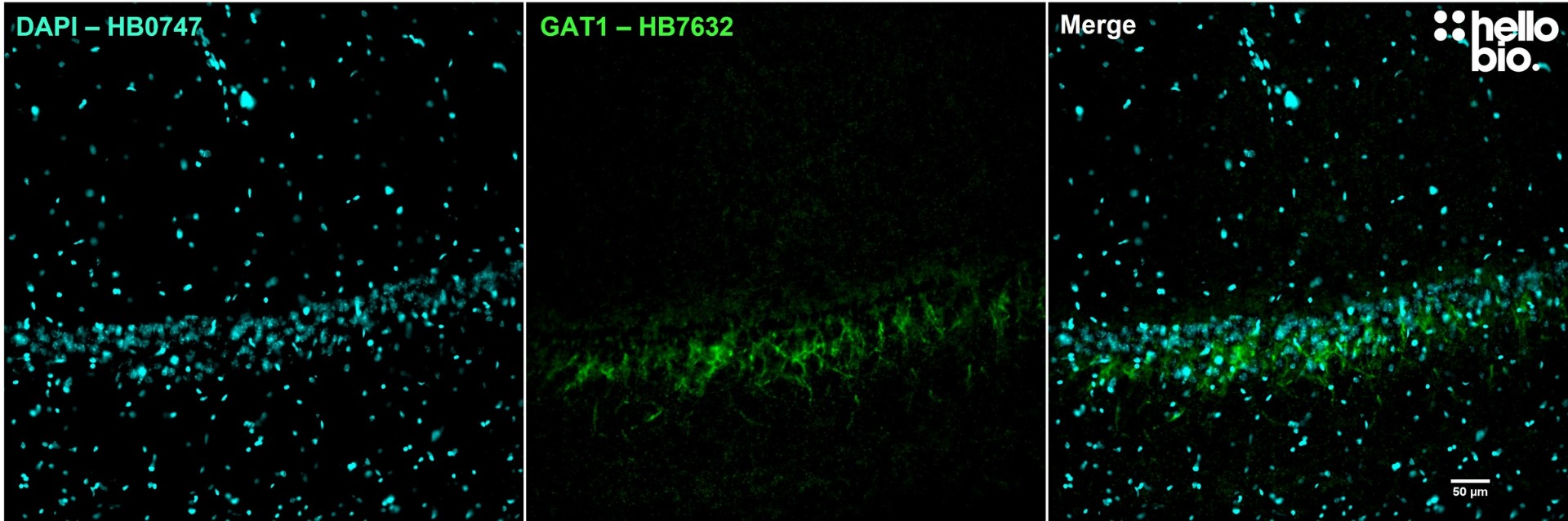 Figure 3. GAT1 staining in the GABAergic interneurons of hippocampal CA1 using HB7632.