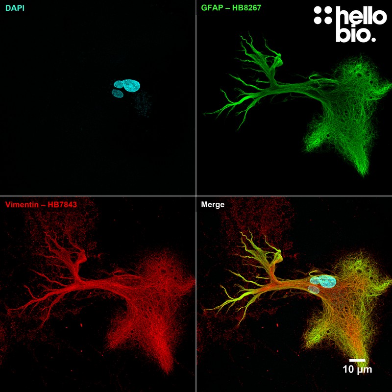 Figure 1. Vimentin and GFAP co-expression within astrocytes found within cultured neurons.