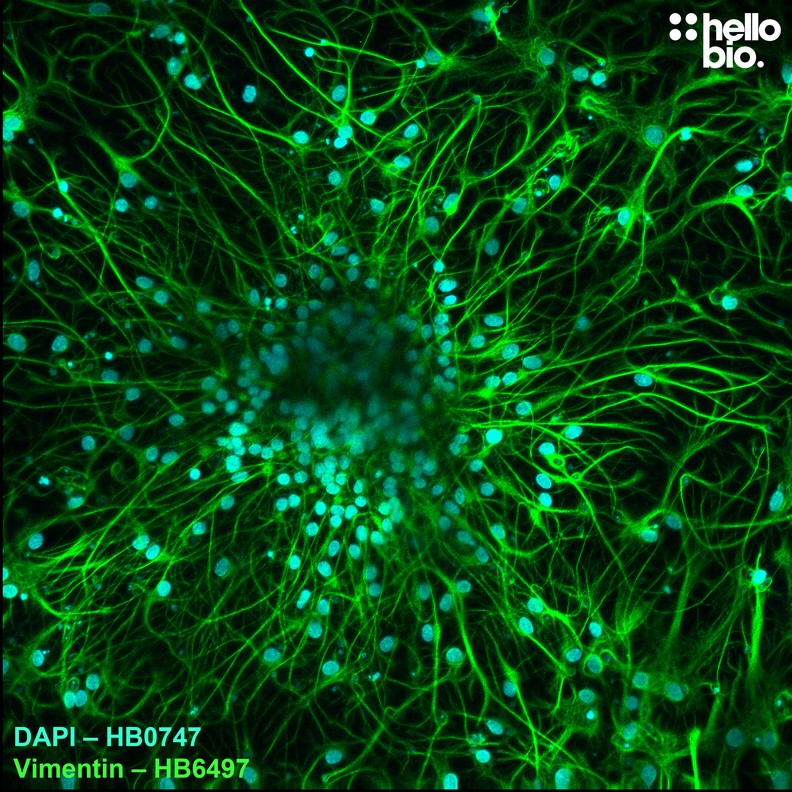 Figure 7. Vimentin expression in glia found within a cultured rat neuron preparation revealed using HB6497.
