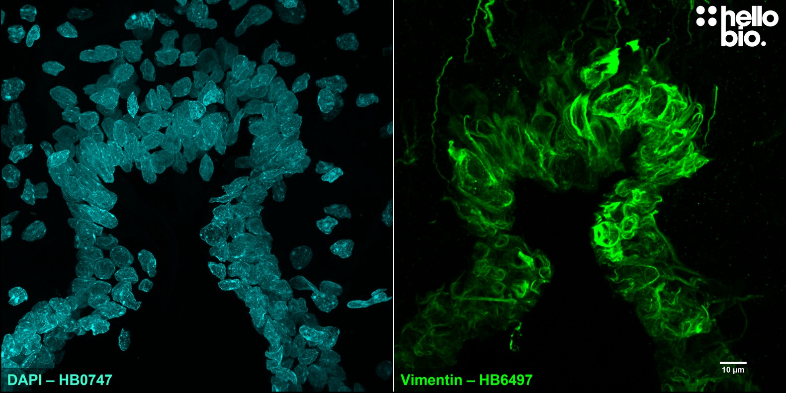 Figure 10. Vimentin expression revealed around the edges of cerebral ventricles in rat brain.