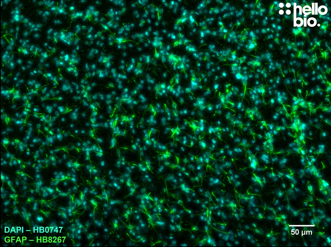 Figure 12. Dense populations of astrocytes in rat brain visualised using HB8267