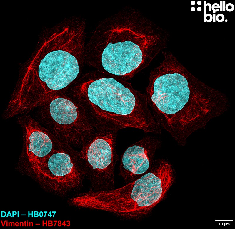 Figure 6. Vimentin expression in HeLa cells visualised using HB7843.
