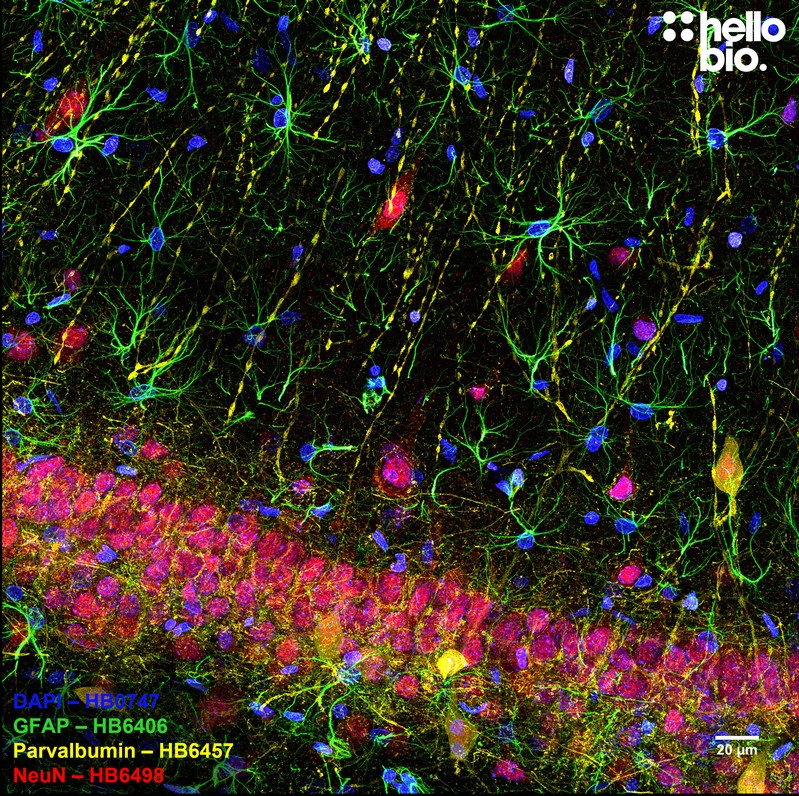 Figure 2. Stained hippocampal CA1 showing astrocytes, neurons and parvalbumin positive interneurons.