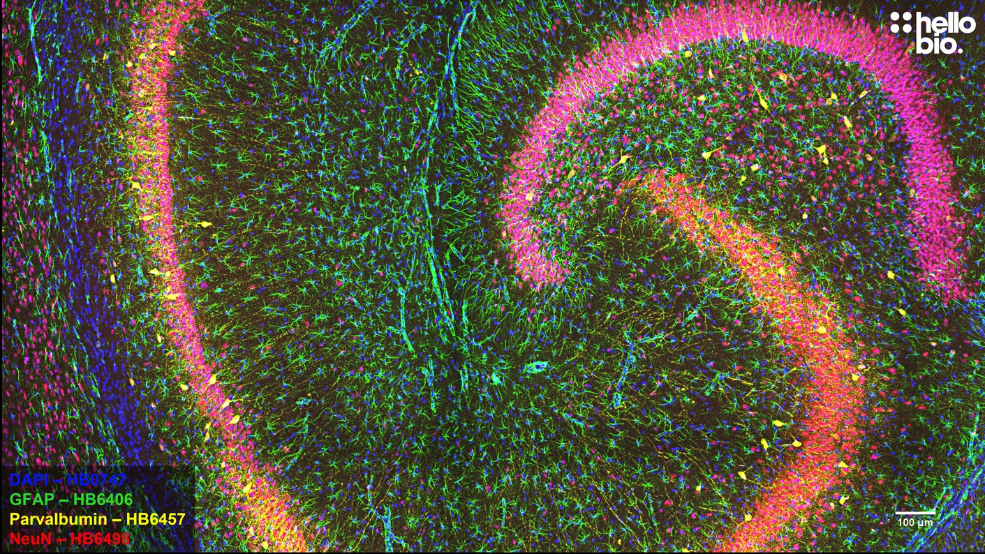 Figure 3. Whole hippocampal section showing astrocytes, neurons and parvalbumin positive interneurons.