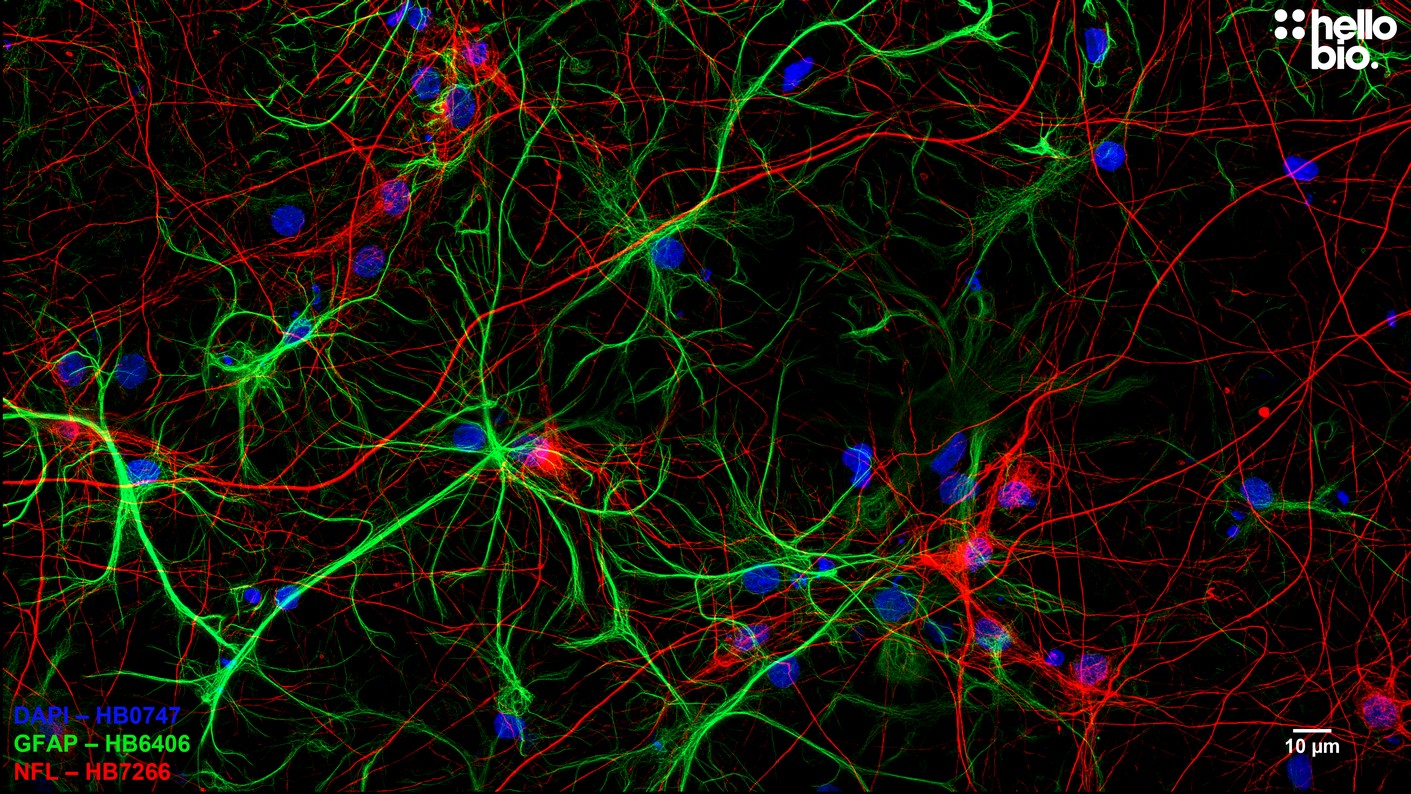 Figure 4. Populations of astrocytes and neurons in a cultured rat neuron preparation.