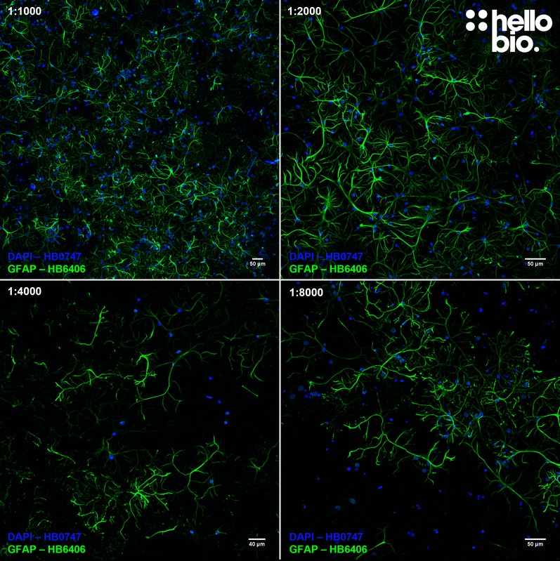 Figure 6. Concentration response of HB6406 staining in cultured rat neurons.