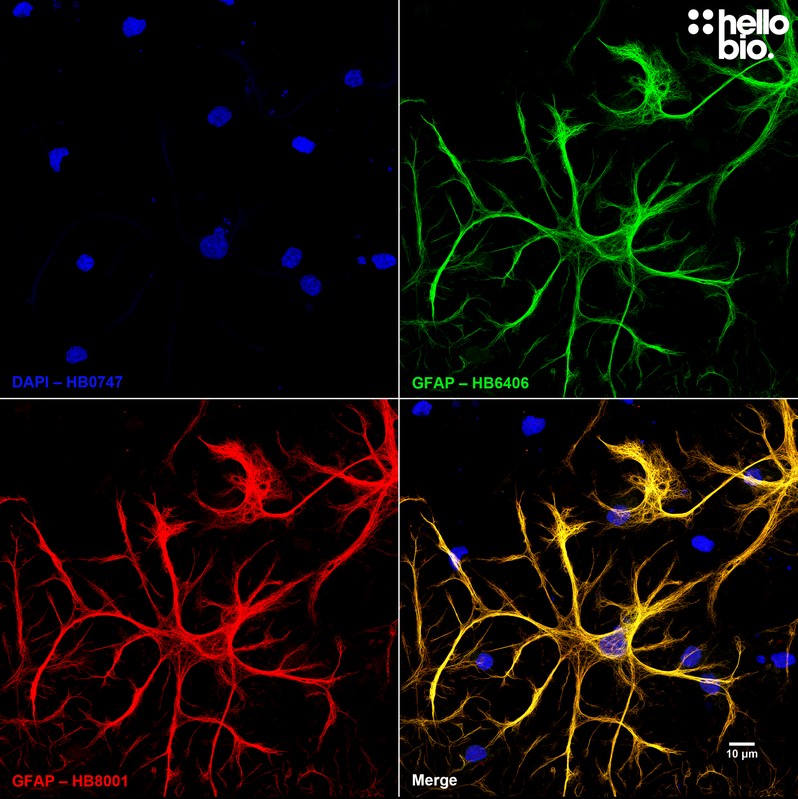 Figure 9. Independent antibody validation of HB6406 and HB8001 in a cultured rat neuron preparation.