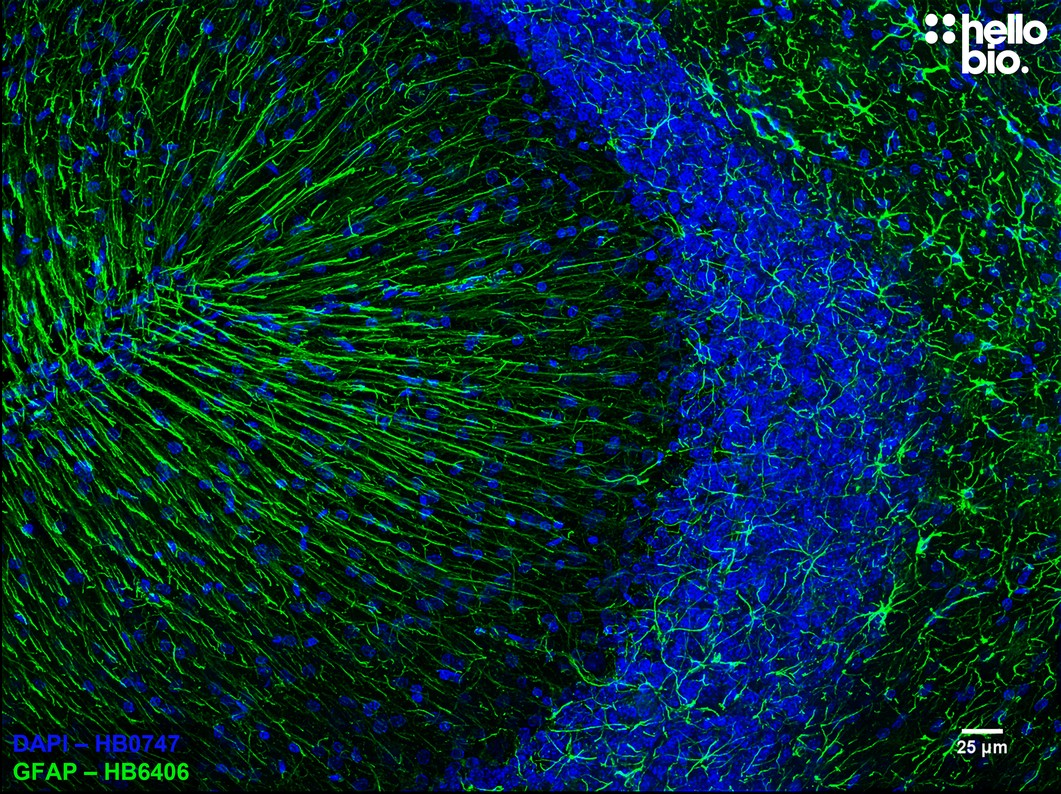 Figure 11. Astrocytes stained for GFAP with HB6406 in the cerebellum