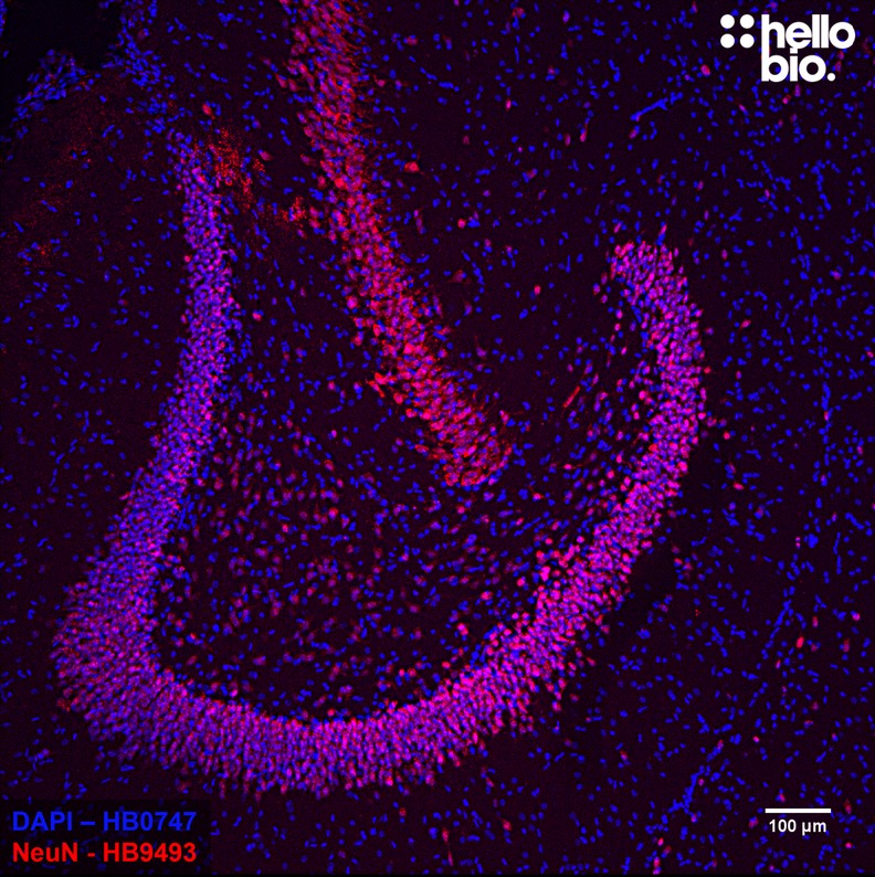 Figure 1. NeuN expressing neurons in the dentate gyrus visualised using HB9493.