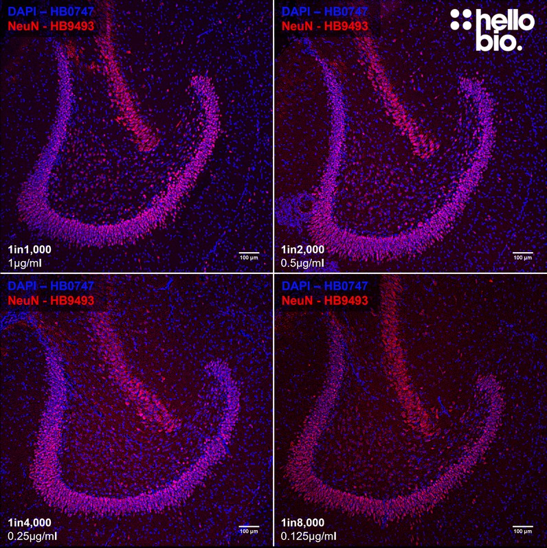 Figure 2. Concentration response of HB9493 staining in rat dentate gyrus.