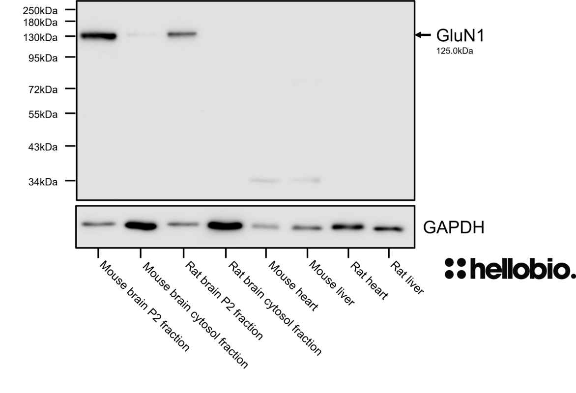 Figure 2. GluN1 expression in brain P2 membrane fractions when probed with HB7535.