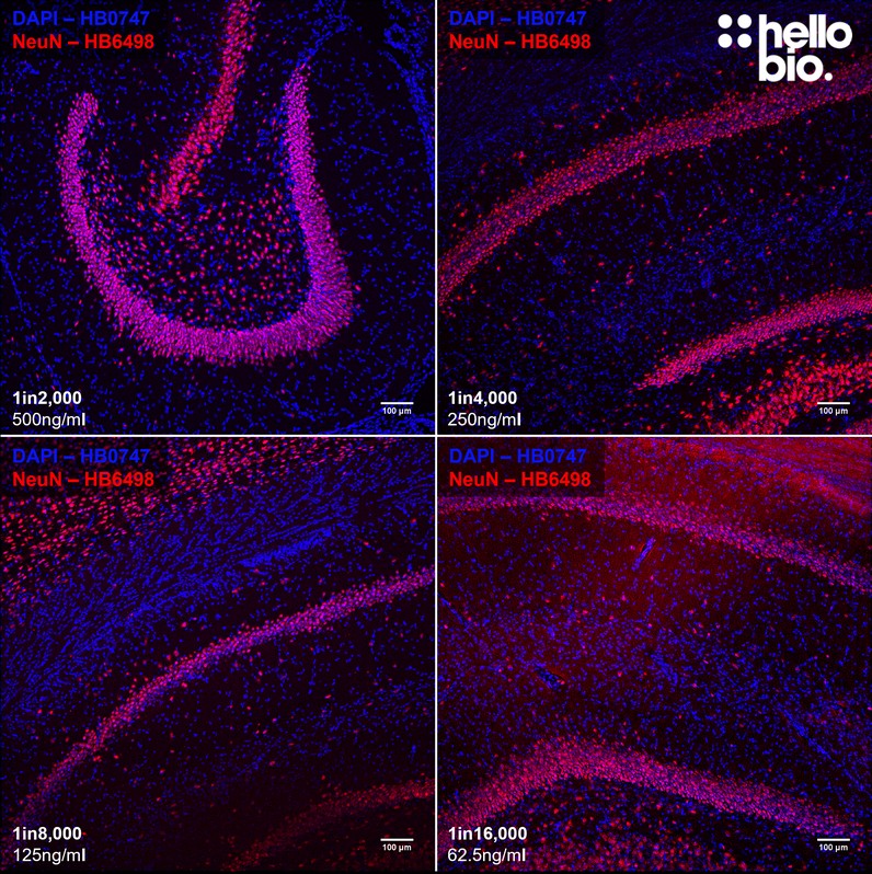 Figure 4. Concentration response of HB6498 staining in rat hippocampal sections.