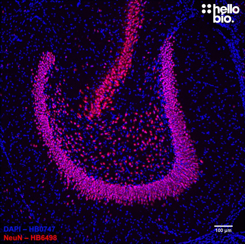 Figure 9. NeuN expressing neurons in the rat dentate gyrus visualised using HB6498